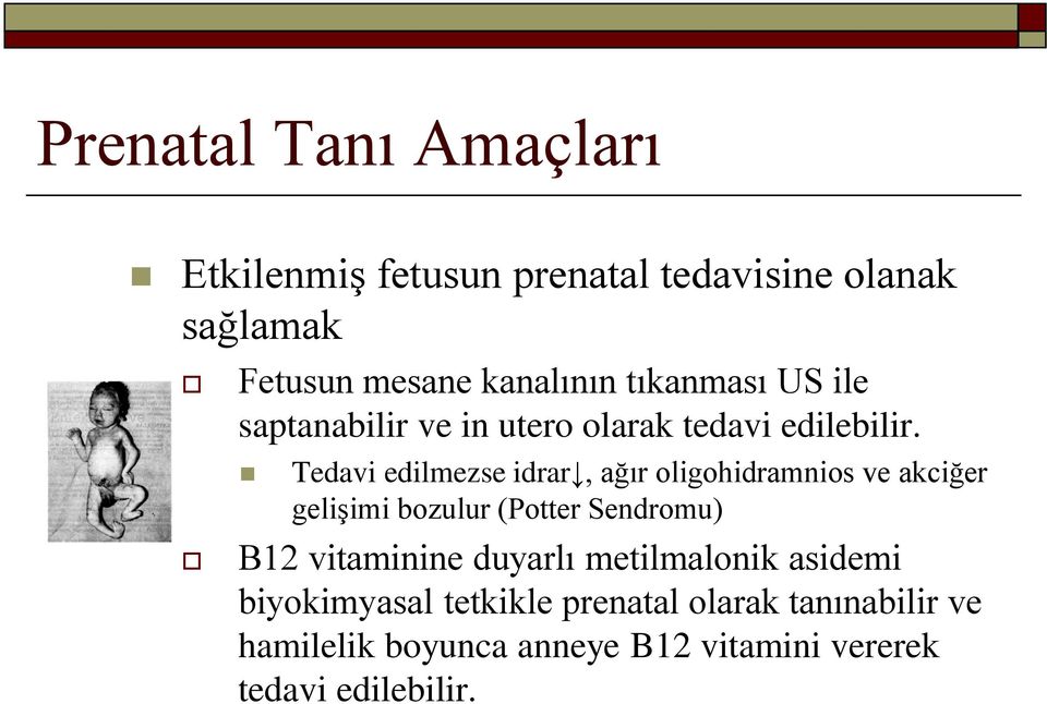 Tedavi edilmezse idrar, ağır oligohidramnios ve akciğer gelişimi bozulur (Potter Sendromu) B12 vitaminine