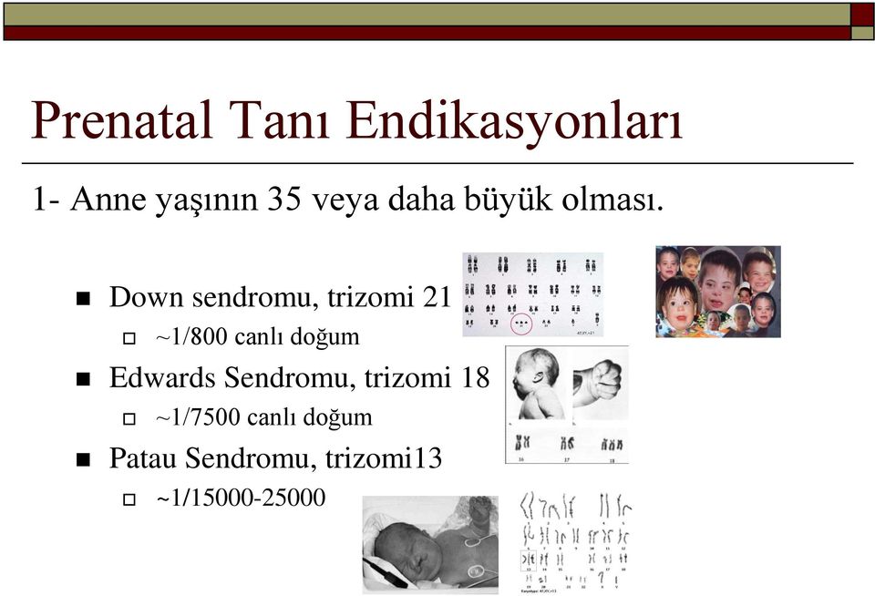 Down sendromu, trizomi 21 ~1/800 canlı doğum