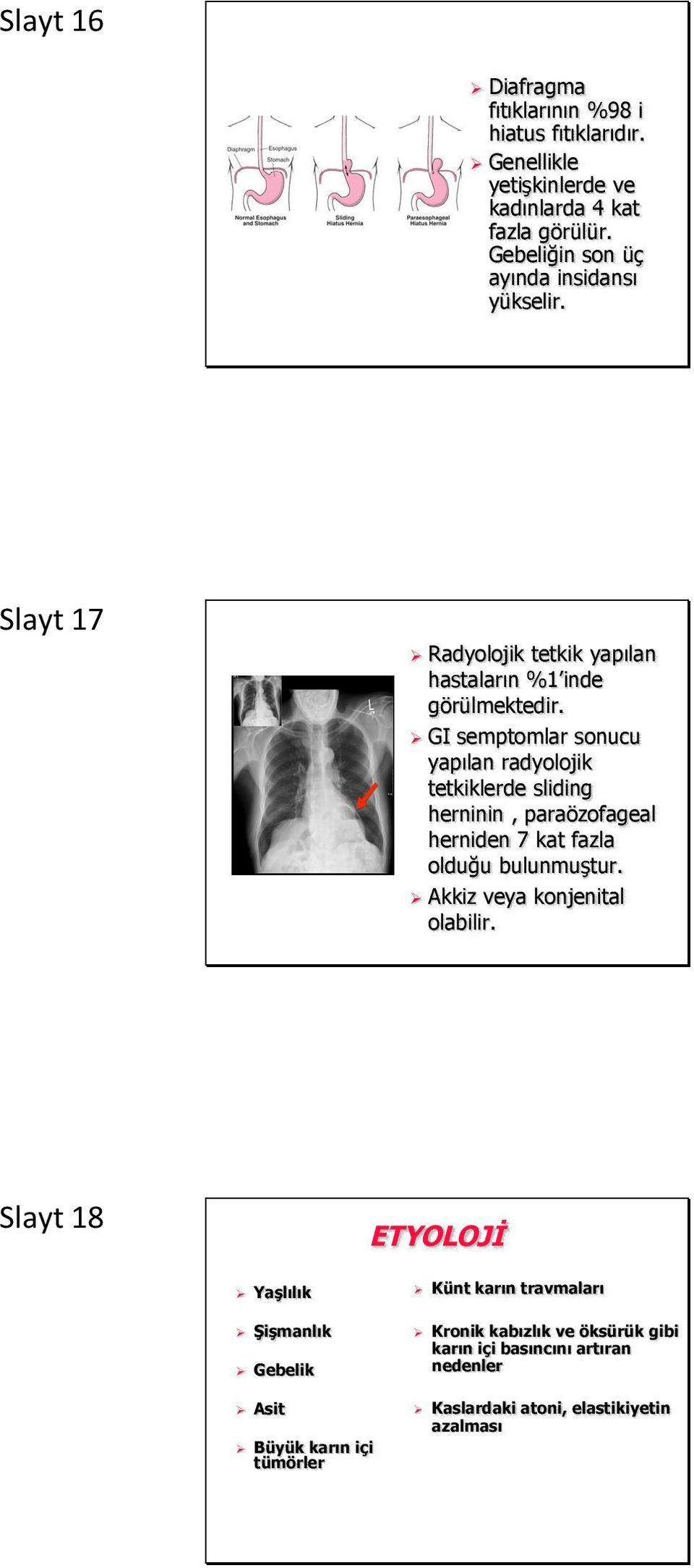 GI semptomlar sonucu yapılan radyolojik tetkiklerde sliding herninin, paraözofageal herniden 7 kat fazla olduğu bulunmuştur.