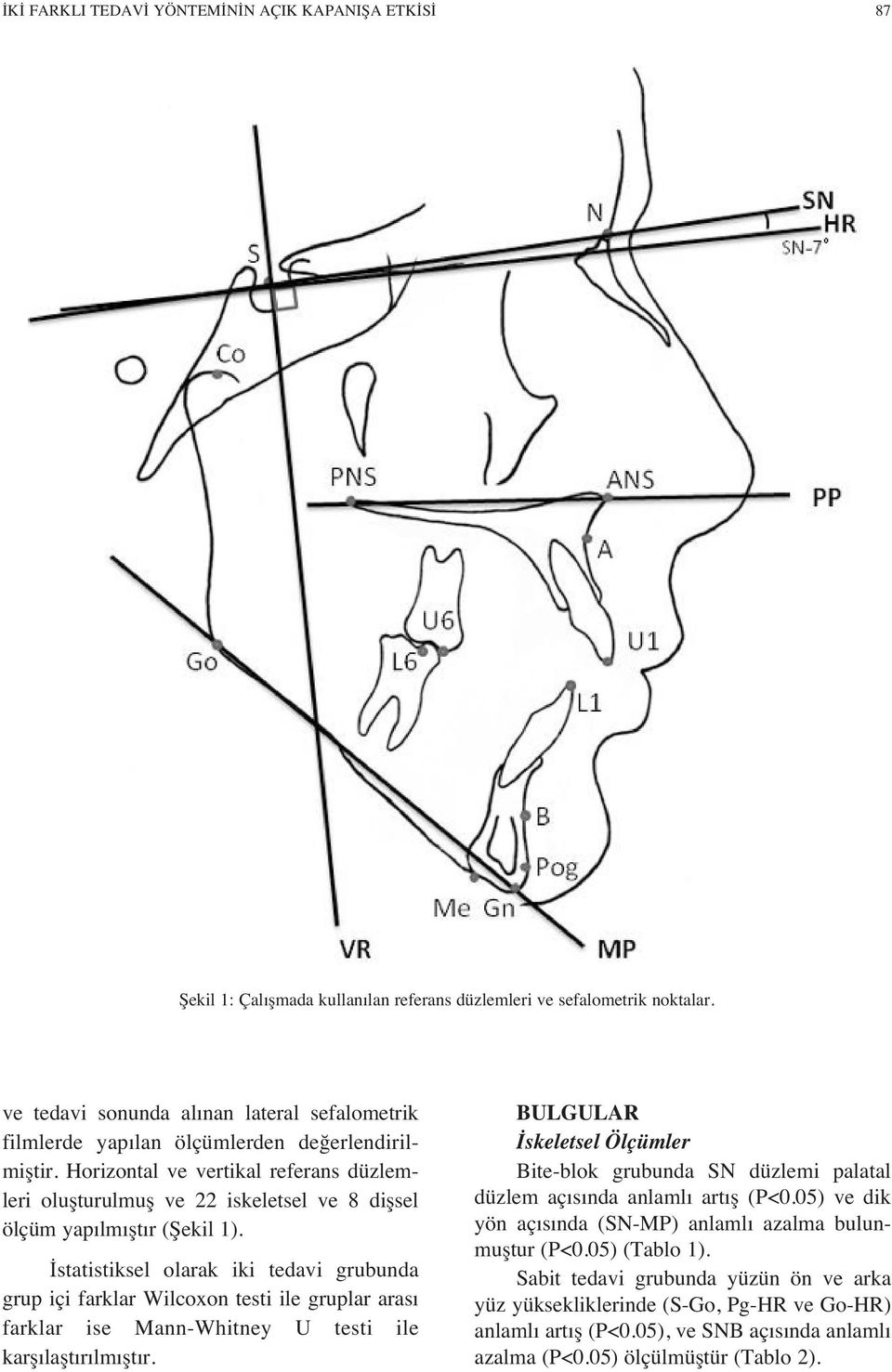 Horizontal ve vertikal referans düzlemleri oluşturulmuş ve 22 iskeletsel ve 8 dişsel ölçüm yap lm şt r (Şekil 1).