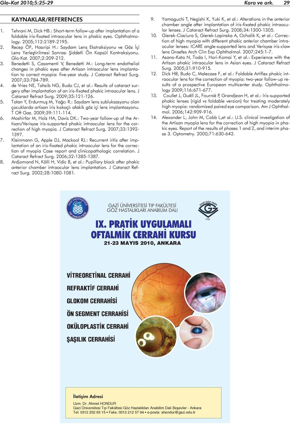 Benedetti S, Casamenti V, Benedetti M.: Long-term endothelial changes in phakic eyes after Artisan intraocular lens implantation to correct myopia: five-year study. J Cataract Refract Surg.