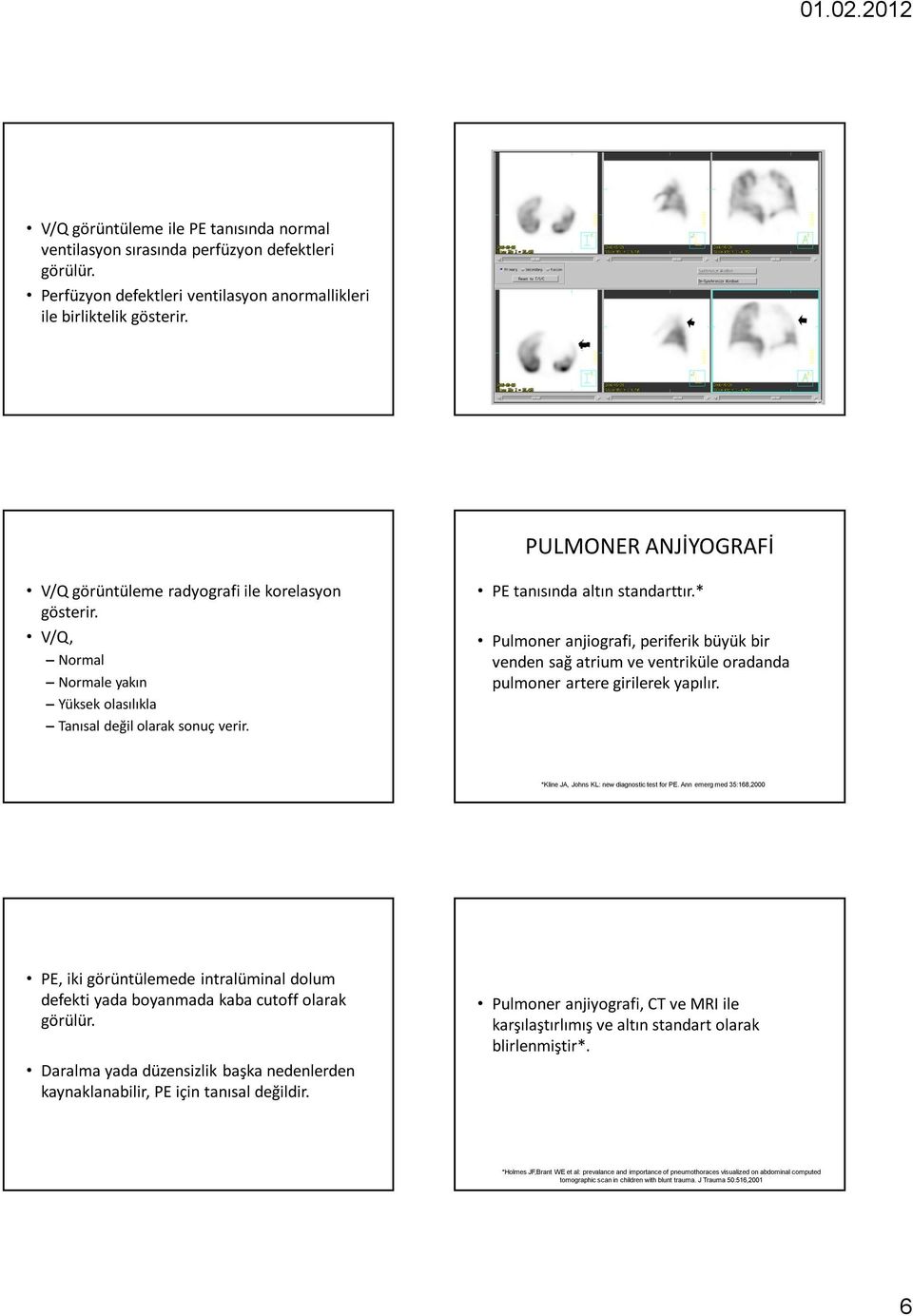 * Pulmoner anjiografi, periferik büyük bir venden sağ atrium ve ventriküle oradanda pulmoner artere girilerek yapılır. 33 *Kline JA, Johns KL: new diagnostic test for PE.