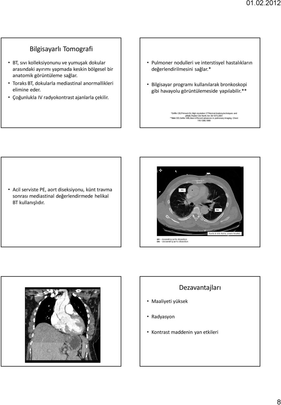 * Bilgisayar programı kullanılarak bronkoskopi gibi havayolu görüntülemeside yapılabilir.** 43 *Griffin CB,Primack SL:High resolution CT:Normal Anatony,techniques and pitfalls.