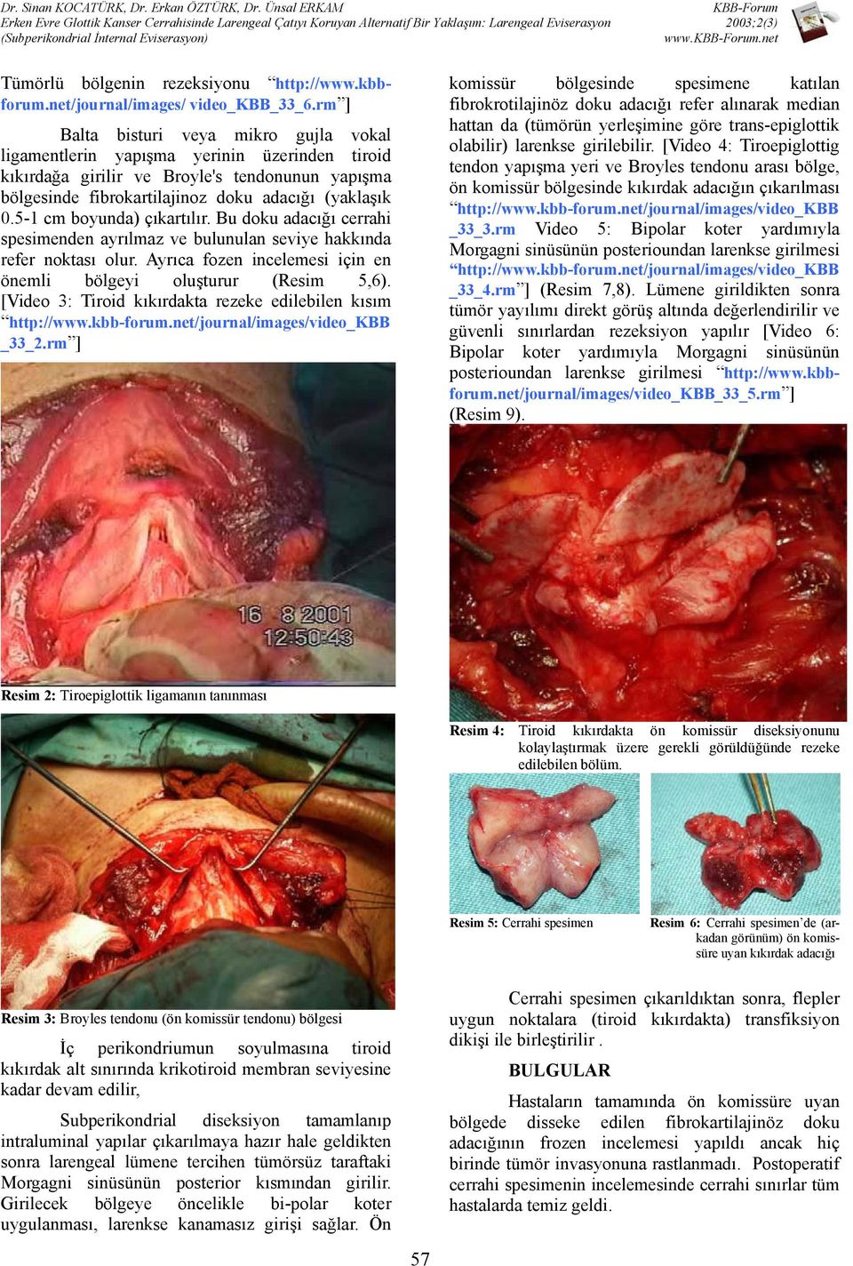 5-1 cm boyunda) çıkartılır. Bu doku adacığı cerrahi spesimenden ayrılmaz ve bulunulan seviye hakkında refer noktası olur. Ayrıca fozen incelemesi için en önemli bölgeyi oluşturur (Resim 5,6).