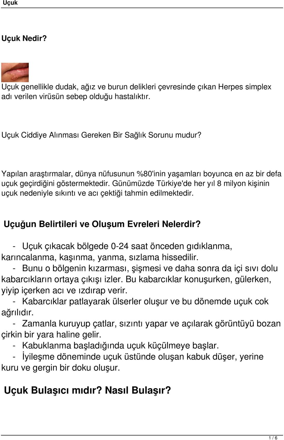 Günümüzde Türkiye'de her yıl 8 milyon kişinin uçuk nedeniyle sıkıntı ve acı çektiği tahmin edilmektedir. Uçuğun Belirtileri ve Oluşum Evreleri Nelerdir?