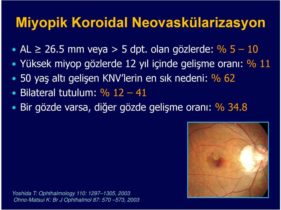 gelişen KNV lerin en sık nedeni: % 62 Bilateral tutulum: % 12 41 Bir gözde varsa, diğer