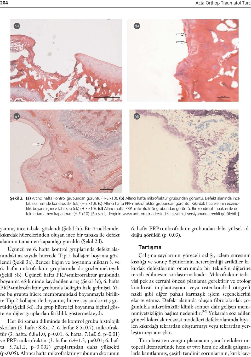 (d) Alt nc hafta PRP+mikrofraktür grubundan görüntü. Bir kondrosit tabakas ile defektin tamamen kapanmas (H-E x10). [Bu flekil, derginin www.aott.org.