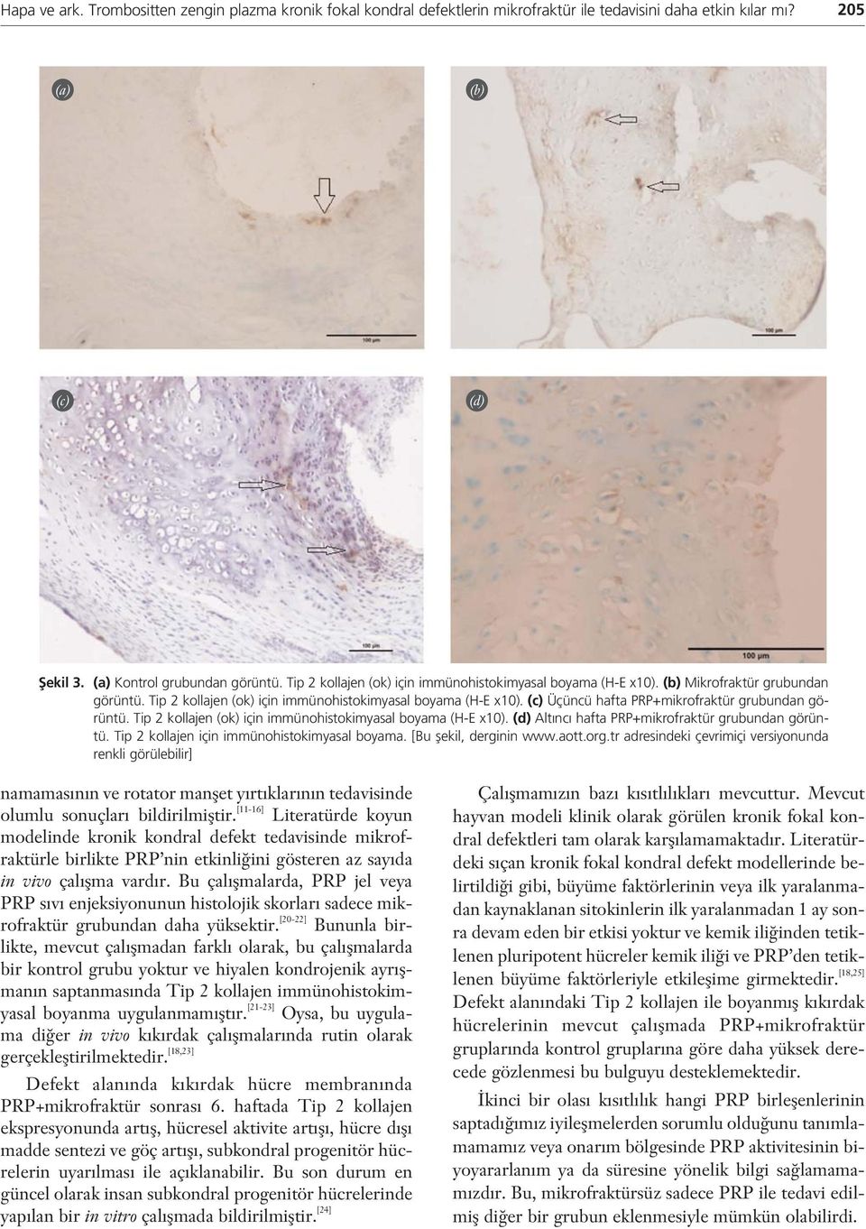 (c) Üçüncü hafta PRP+mikrofraktür grubundan görüntü. Tip 2 kollajen (ok) için immünohistokimyasal boyama (H-E x10). (d) Alt nc hafta PRP+mikrofraktür grubundan görüntü.