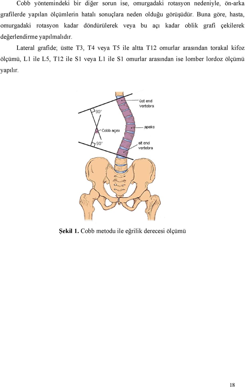 Buna göre, hasta, omurgadaki rotasyon kadar döndürülerek veya bu açı kadar oblik grafi çekilerek değerlendirme yapılmalıdır.
