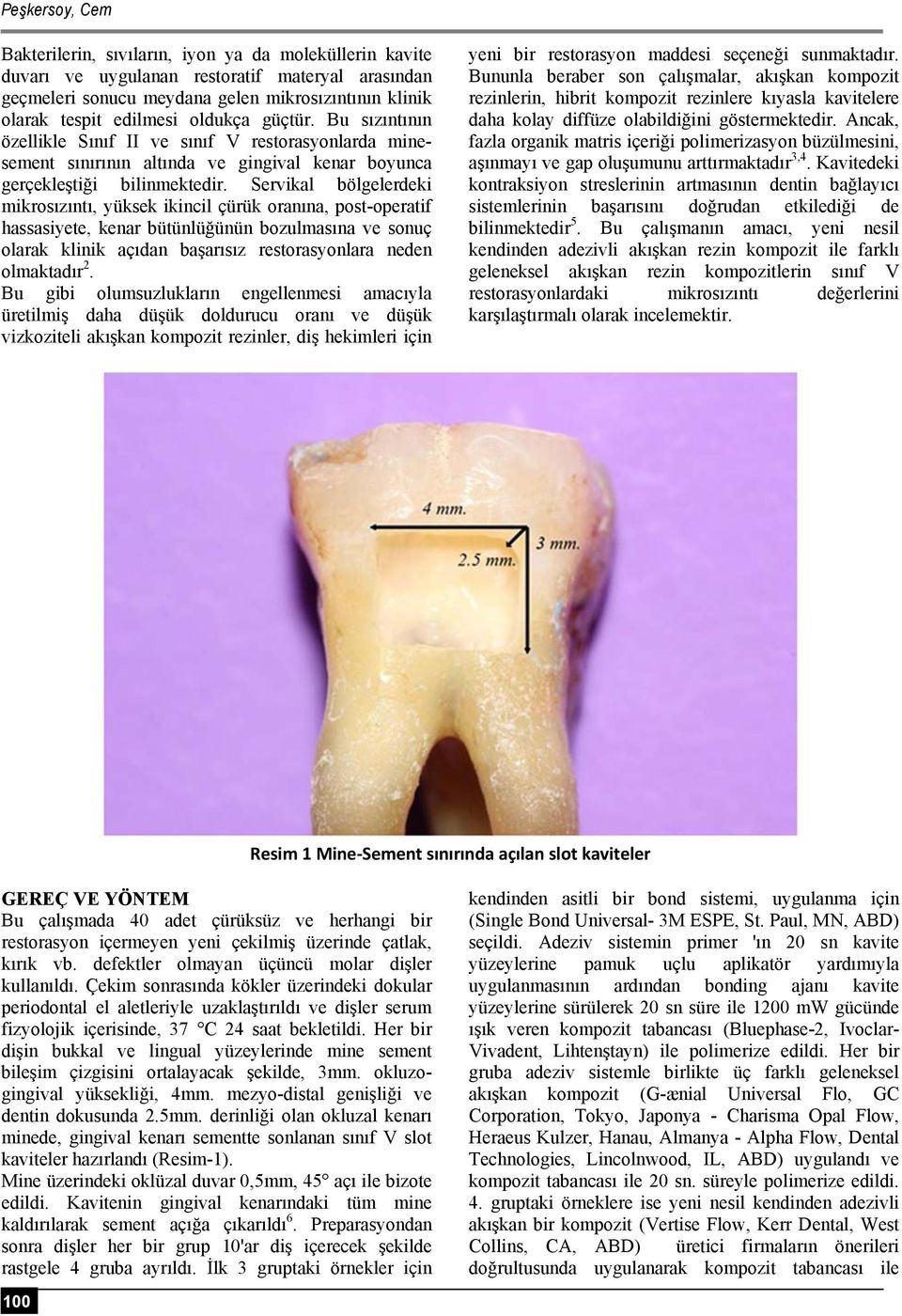 Servikal bölgelerdeki mikrosızıntı, yüksek ikincil çürük oranına, post-operatif hassasiyete, kenar bütünlüğünün bozulmasına ve sonuç olarak klinik açıdan başarısız restorasyonlara neden olmaktadır 2.