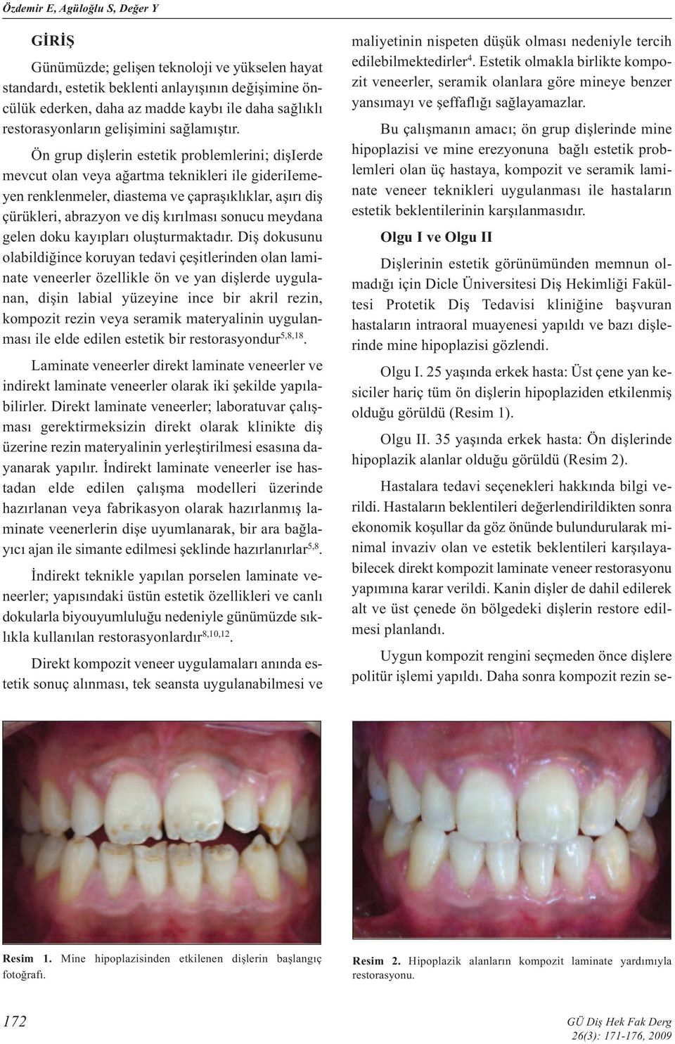 Ön grup dişlerin estetik problemlerini; dişierde mevcut olan veya ağartma teknikleri ile gideriiemeyen renklenmeler, diastema ve çapraşıklıklar, aşırı diş çürükleri, abrazyon ve diş kırılması sonucu