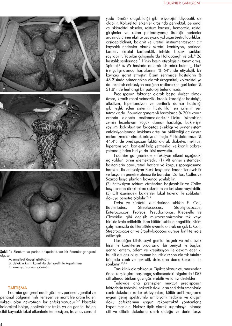 - Hastalık kolorektal bölge, genitoüriner trakt, ya da genital bölge cildi kaynaklı lokal etkenlerle (enfeksiyon, travma, cerrahi yada tümör) oluşabildiği gibi etiyolojisi idiyopatik de olabilir.