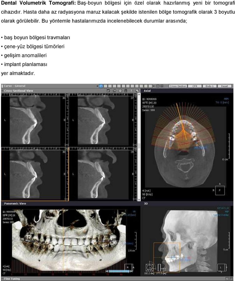 Hasta daha az radyasyona maruz kalacak şekilde istenilen bölge tomografik olarak 3 boyutlu olarak