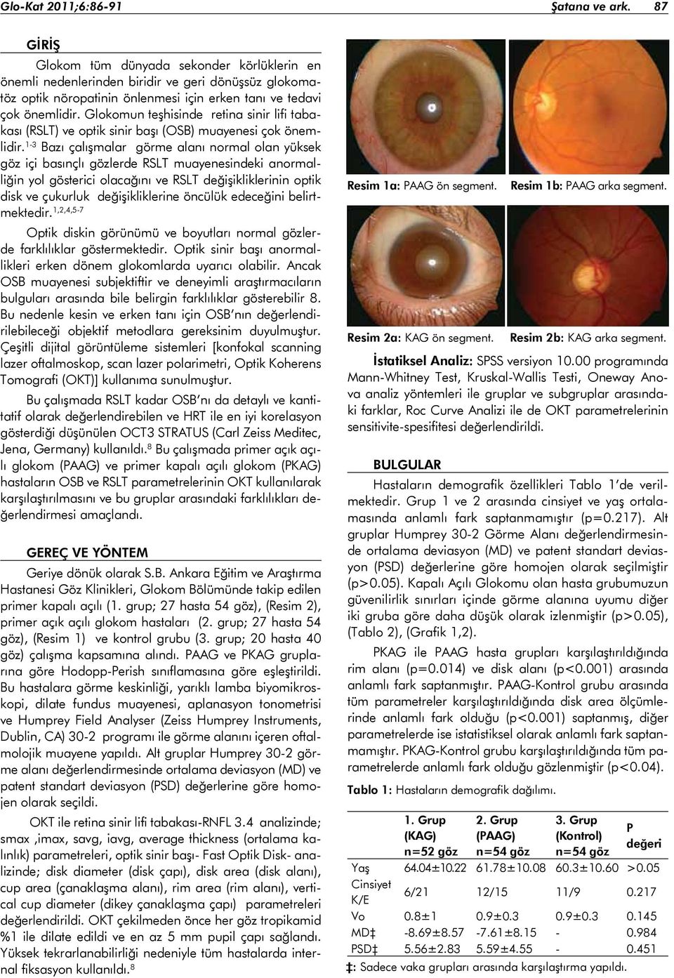 Glokomun teşhisinde retina sinir lifi tabakası (RSLT) ve optik sinir başı (OSB) muayenesi çok önemlidir.
