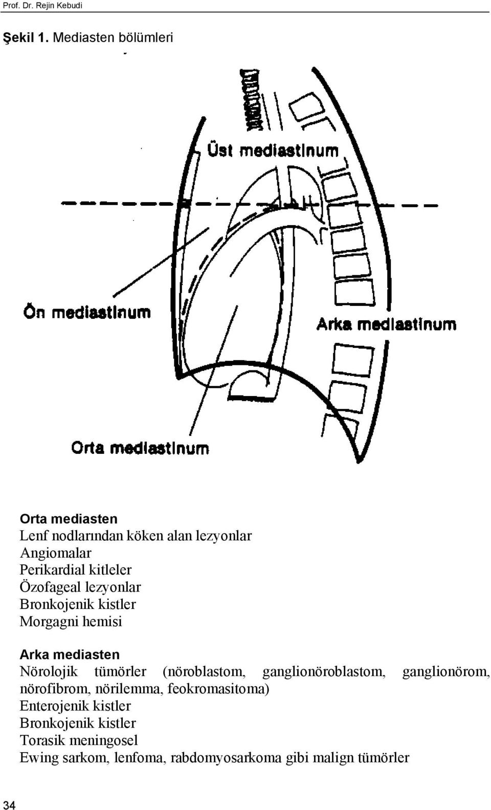 Özofageal lezyonlar Bronkojenik kistler Morgagni hemisi Arka mediasten Nörolojik tümörler (nöroblastom,