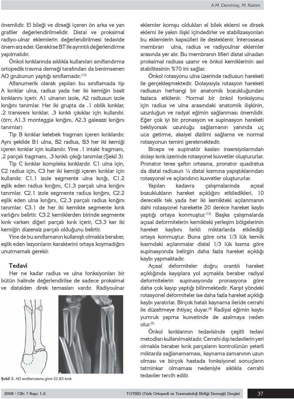 (13) Alfanumerik olarak yapılan bu sınıflamada tip A kırıklar ulna, radius yada her iki kemiğin basit kırıklarını içerir. A1 ulnanın izole, A2 radiusun izole kırığını tanımlar. Her iki grupta da.