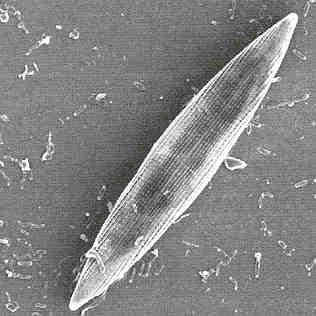 Biofilm - Bacteria Biofilm - Diatoms and protozoa