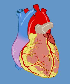 Kalp damarlarına yeterli oksijen gitmemesi sonucu oluşur.