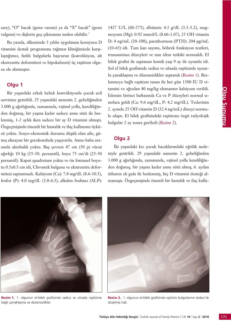 hipokalsemi) üç raflitizm olgusu ele al nm flt r. Olgu 1 Bir yafl ndaki erkek bebek konvülsiyonla çocuk acil servisine getirildi. 25 yafl ndaki annenin 2. gebeli inden 3.