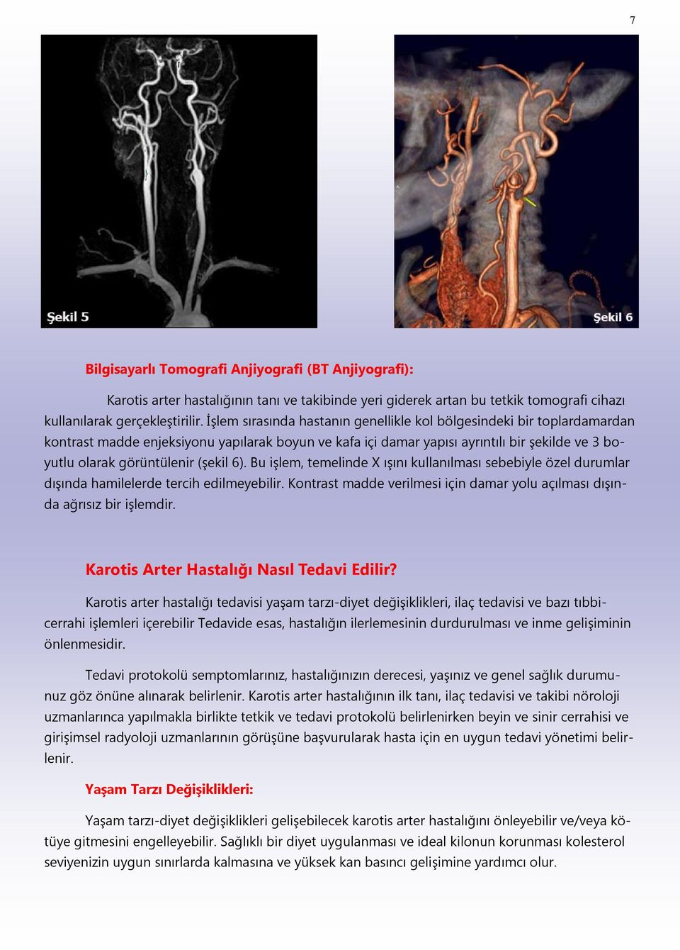 (şekil 6). Bu işlem, temelinde X ışını kullanılması sebebiyle özel durumlar dışında hamilelerde tercih edilmeyebilir. Kontrast madde verilmesi için damar yolu açılması dışında ağrısız bir işlemdir.