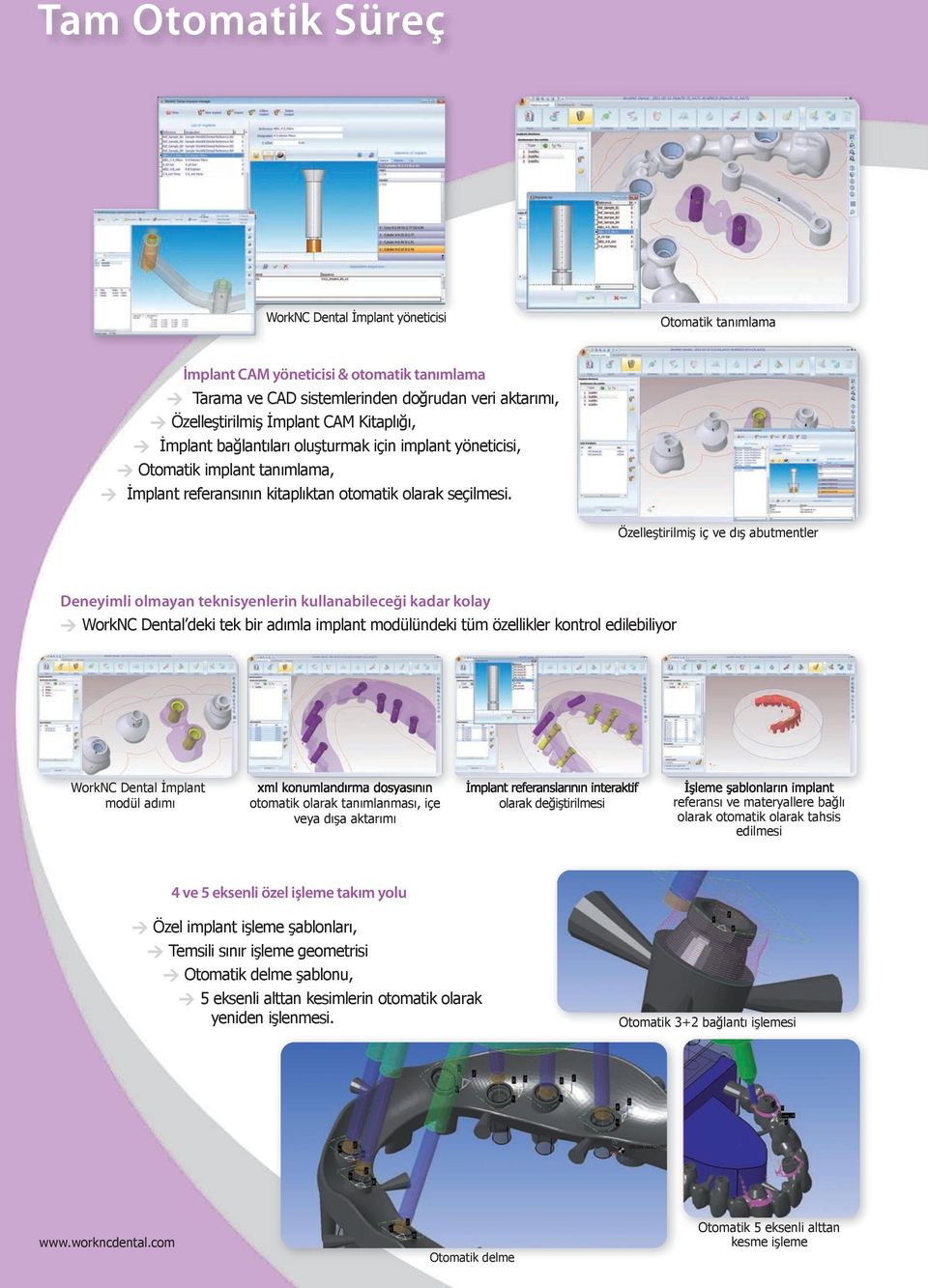 Özelleştirilmiş iç ve dış abutmentler Deneyimli olmayan teknisyenlerin kullanabileceği kadar kolay > WorkNC Dental deki tek bir adımla implant modülündeki tüm özellikler kontrol edilebiliyor WorkNC
