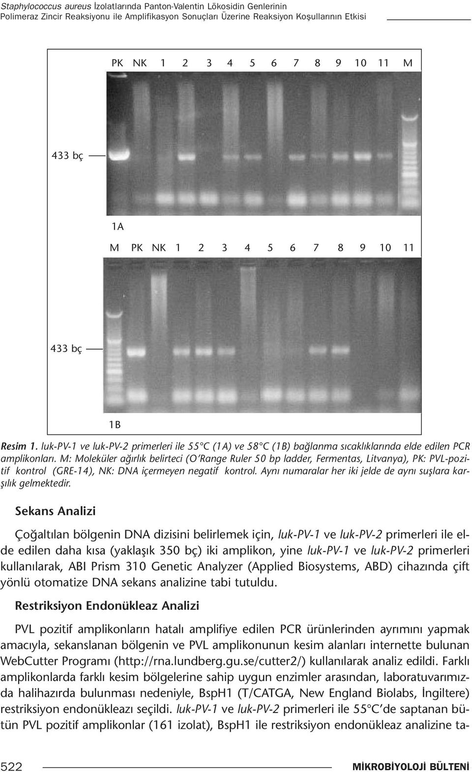 M: Moleküler ağırlık belirteci (O Range Ruler 50 bp ladder, Fermentas, Litvanya), PK: PVL-pozitif kontrol (GRE-14), NK: DNA içermeyen negatif kontrol.