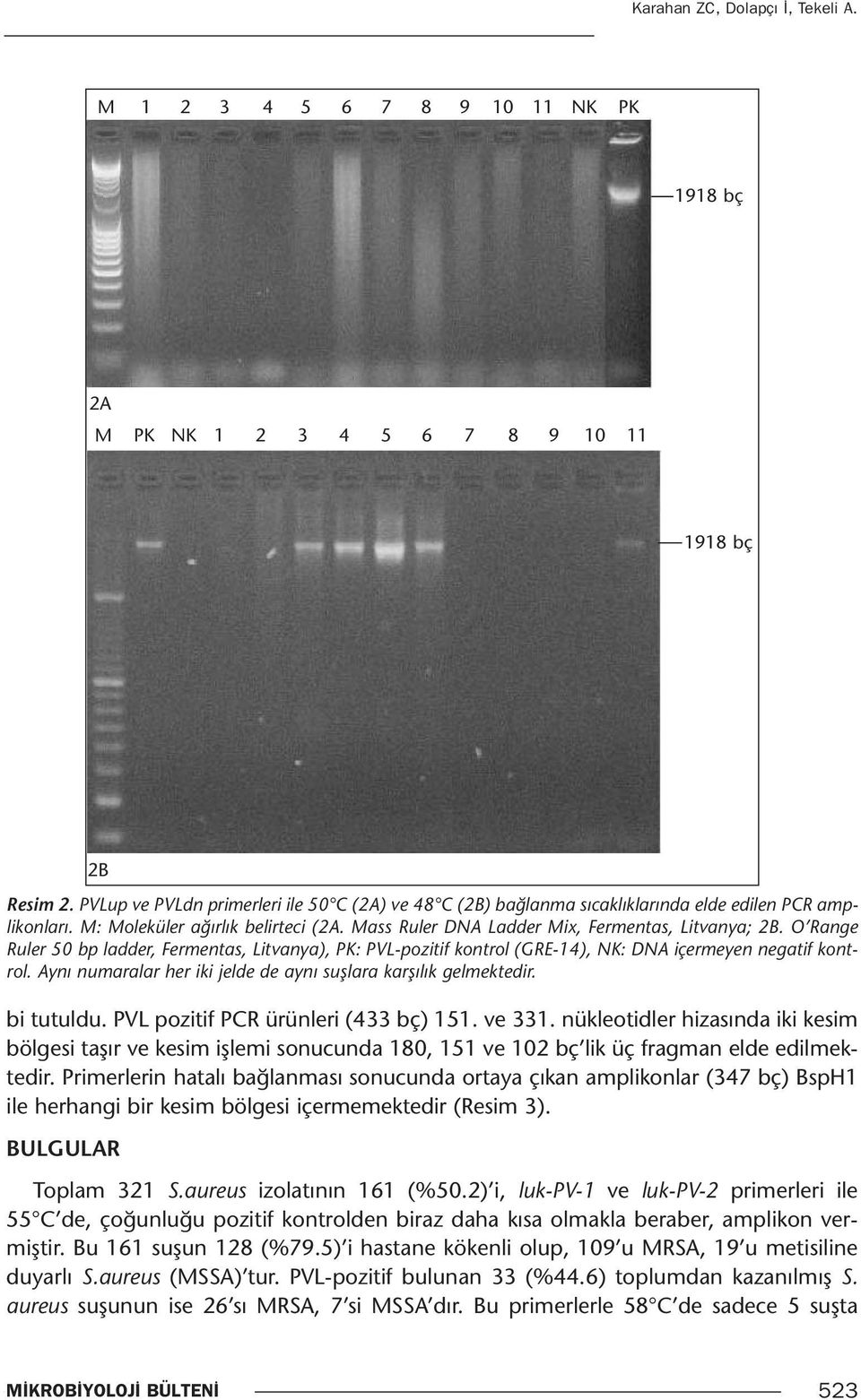 O Range Ruler 50 bp ladder, Fermentas, Litvanya), PK: PVL-pozitif kontrol (GRE-14), NK: DNA içermeyen negatif kontrol. Aynı numaralar her iki jelde de aynı suşlara karşılık gelmektedir. bi tutuldu.