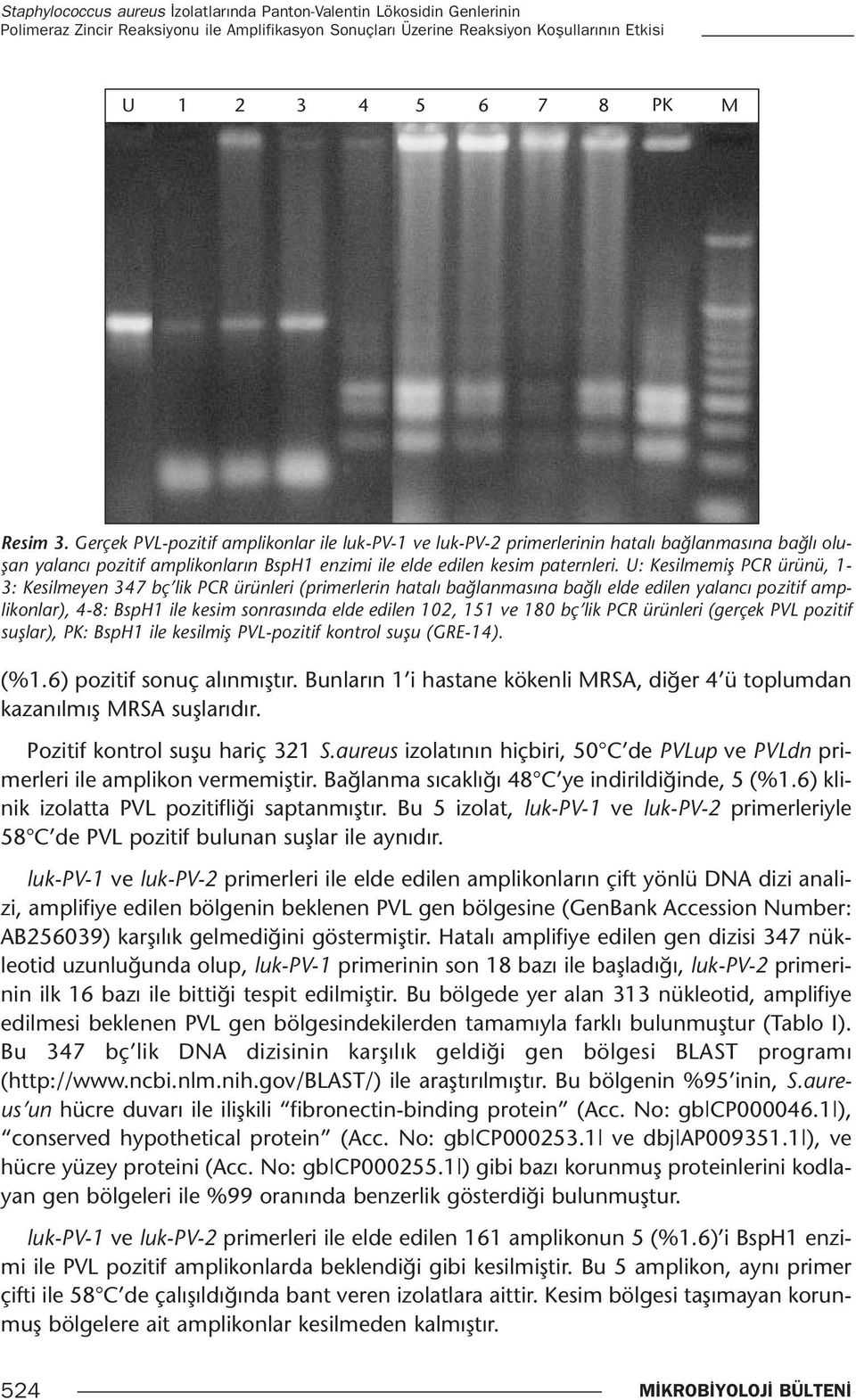 U: Kesilmemiş PCR ürünü, 1-3: Kesilmeyen 347 bç lik PCR ürünleri (primerlerin hatalı bağlanmasına bağlı elde edilen yalancı pozitif amplikonlar), 4-8: BspH1 ile kesim sonrasında elde edilen 102, 151