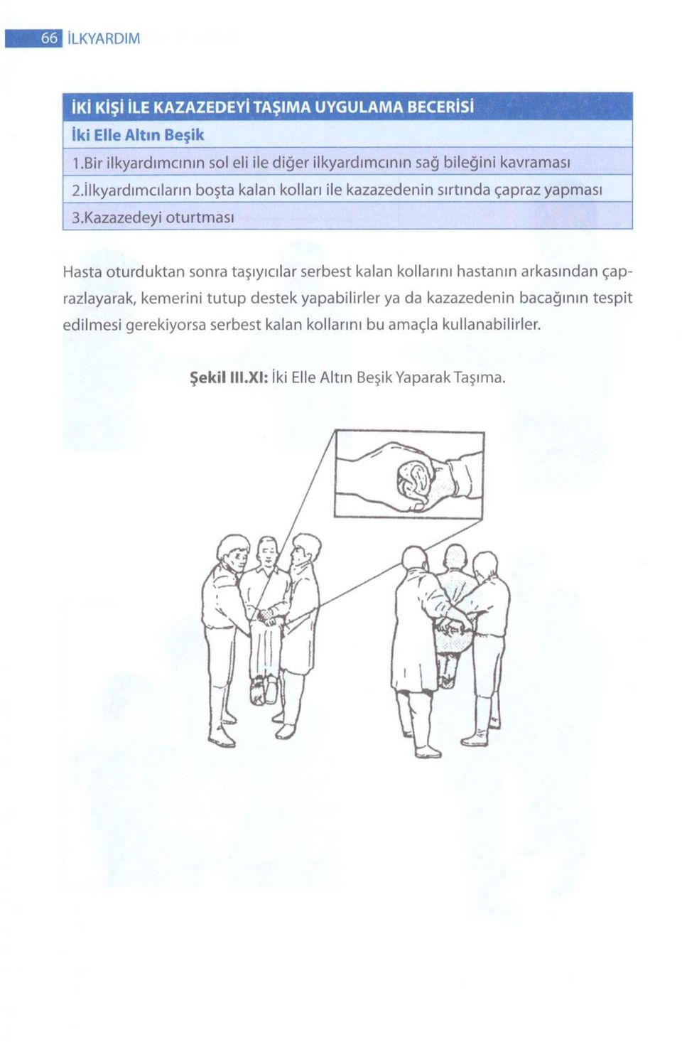 İlkyardımcıların boşta kalan kolları ile kazazedenin sırtında çapraz yapması 3.