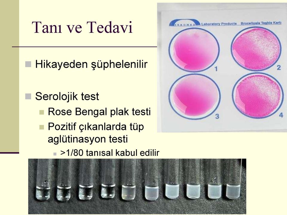 Bengal plak testi Pozitif