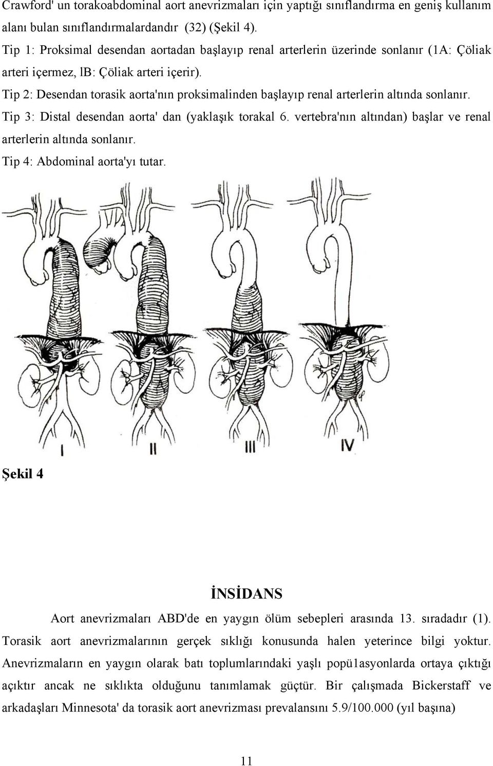 Tip 2: Desendan torasik aorta'nın proksimalinden başlayıp renal arterlerin altında sonlanır. Tip 3: Distal desendan aorta' dan (yaklaşık torakal 6.