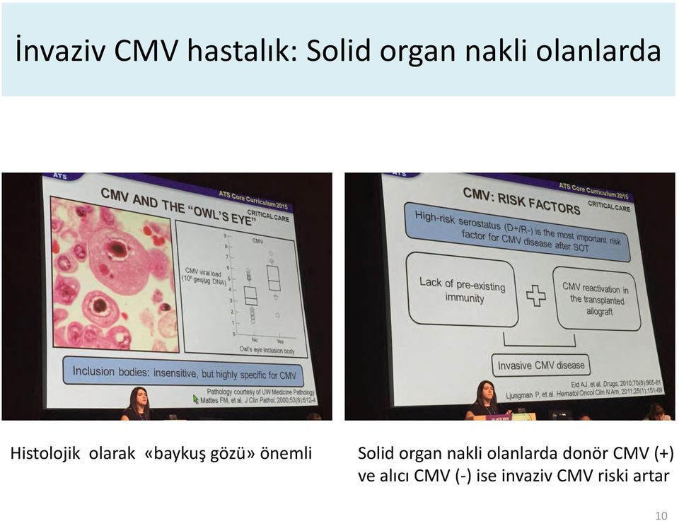 önemli Solid organ nakli olanlarda donör CMV