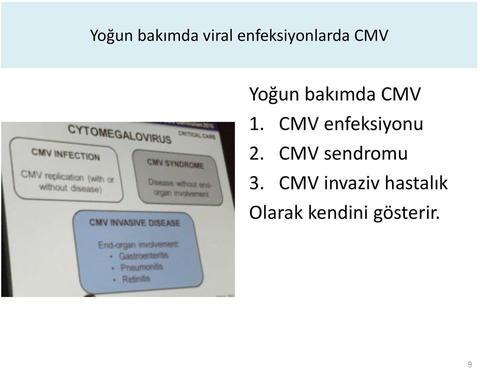 CMV enfeksiyonu 2. CMV sendromu 3.