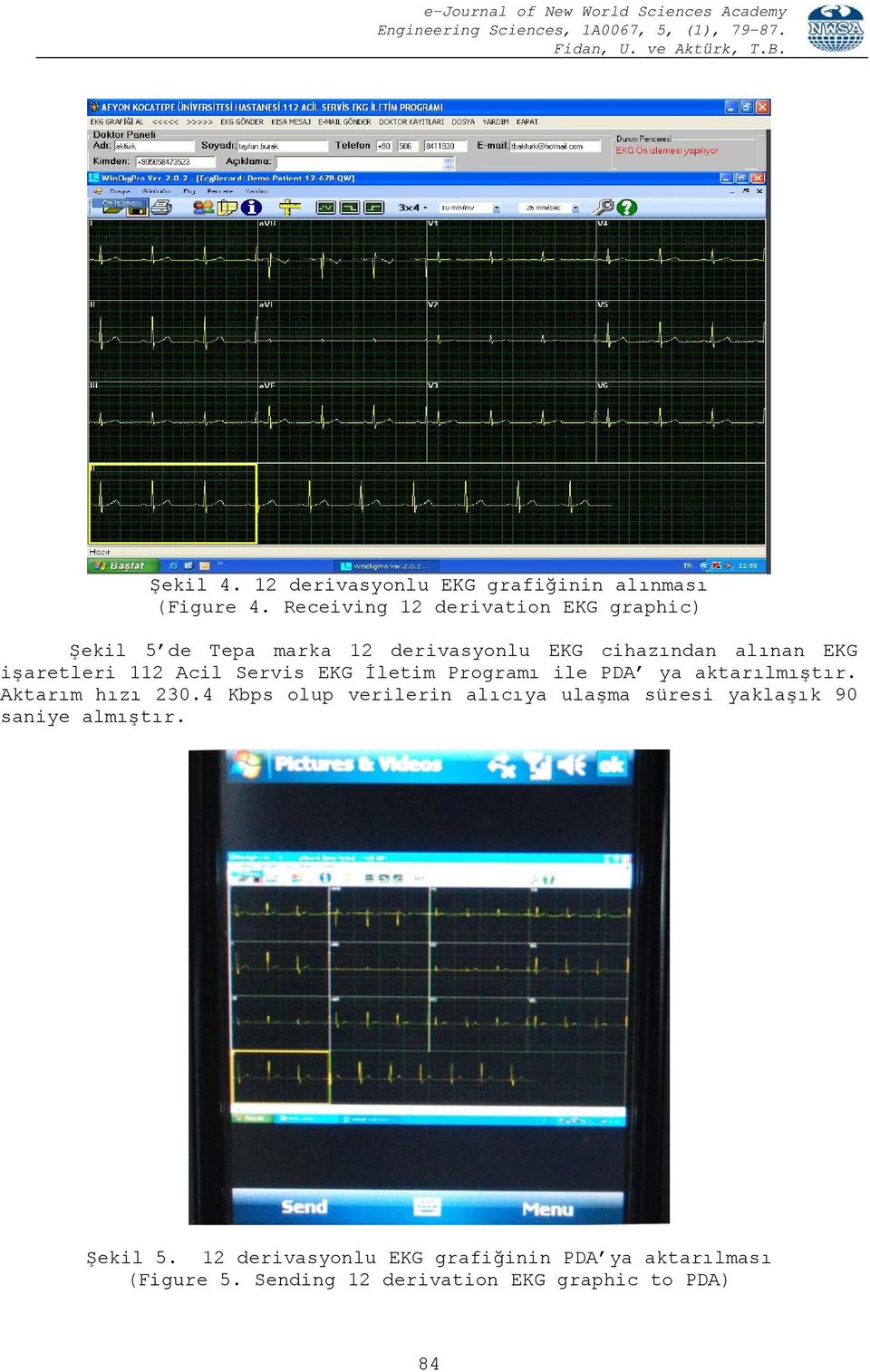işaretleri 112 Acil Servis EKG İletim Programı ile PDA ya aktarılmıştır. Aktarım hızı 230.