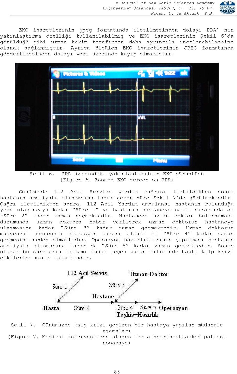 PDA üzerindeki yakınlaştırılmış EKG görüntüsü (Figure 6.