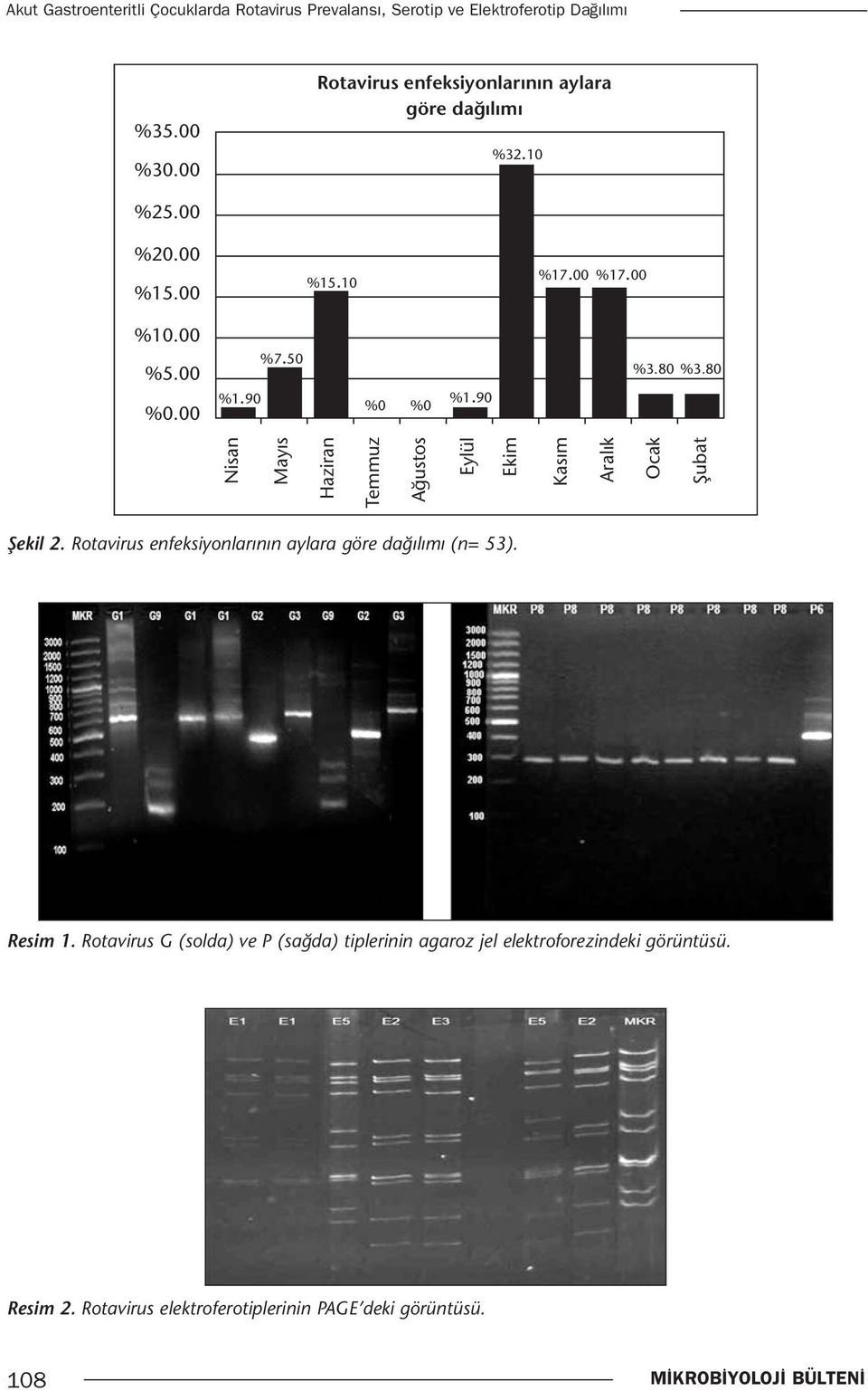 00 %7.50 %5.00 %0.00 %1.90 %0 %0 %1.90 %3.80 %3.80 Şekil 2. Rotavirus enfeksiyonlarının aylara göre dağılımı (n= 53). Resim 1.