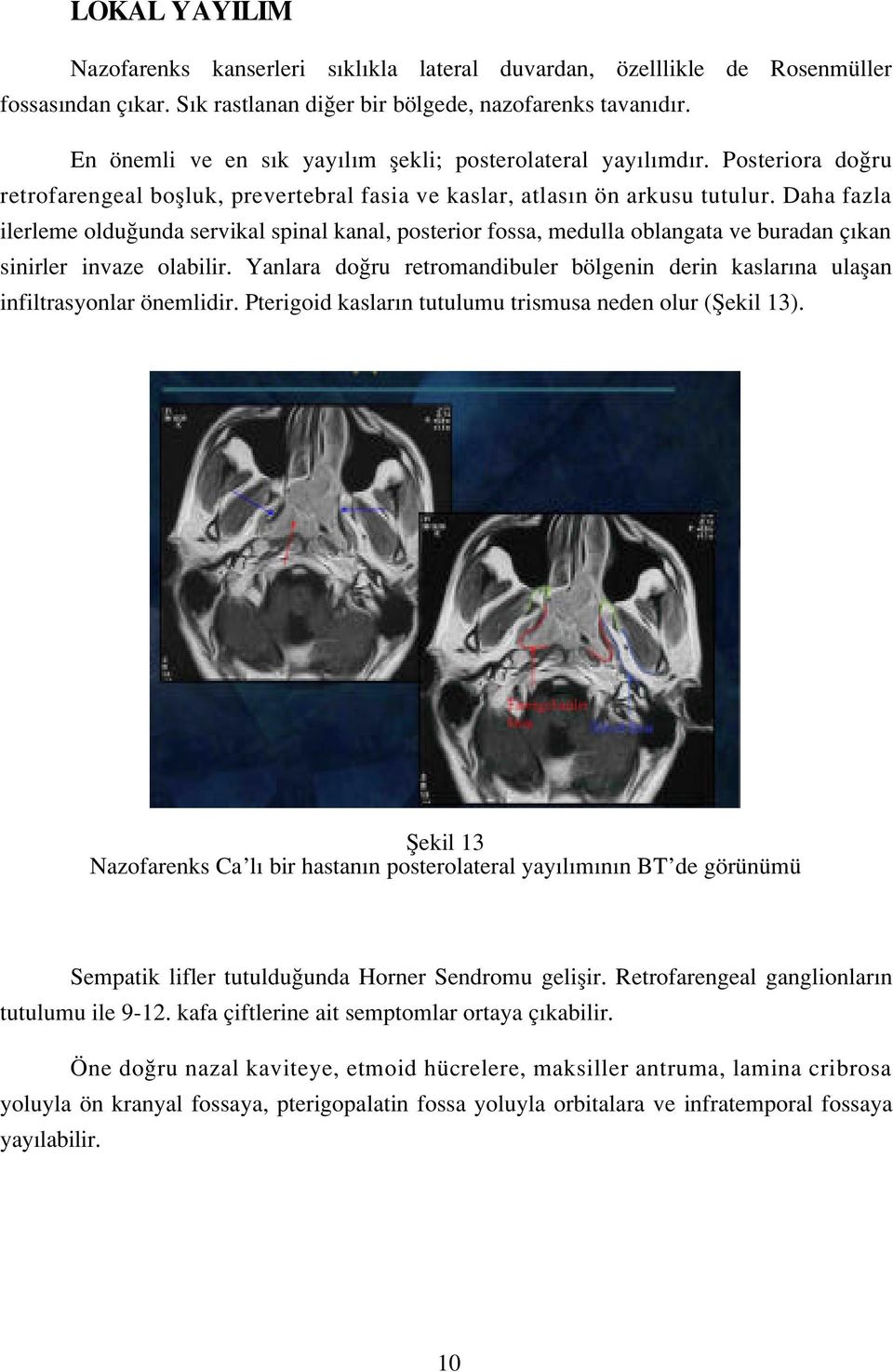 Daha fazla ilerleme oldu unda servikal spinal kanal, posterior fossa, medulla oblangata ve buradan ç kan sinirler invaze olabilir.