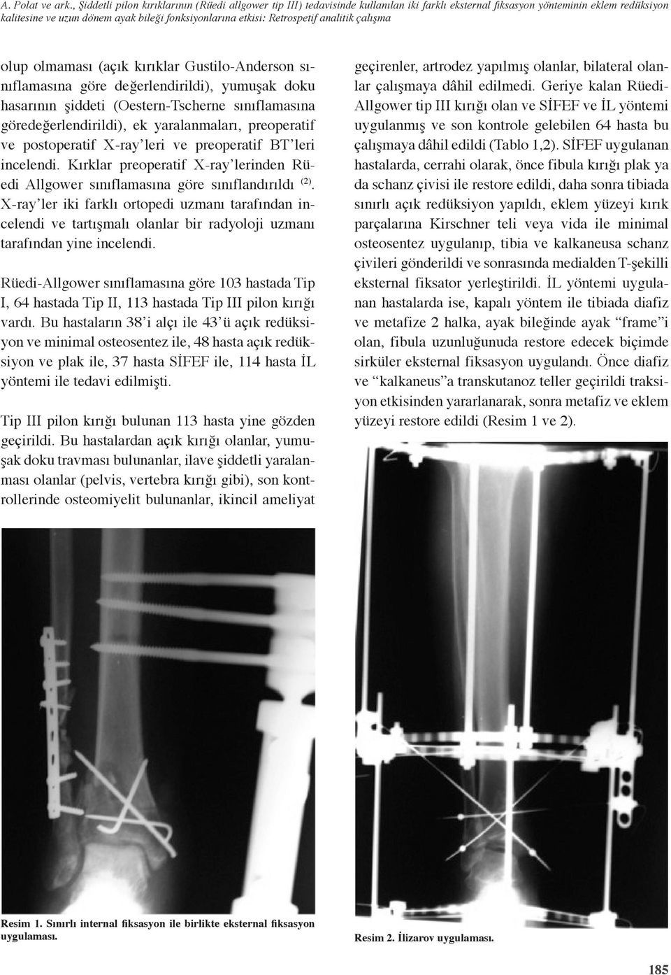 Retrospetif analitik çalışma olup olmaması (açık kırıklar Gustilo-Anderson sınıflamasına göre değerlendirildi), yumuşak doku hasarının şiddeti (Oestern-Tscherne sınıflamasına göredeğerlendirildi), ek