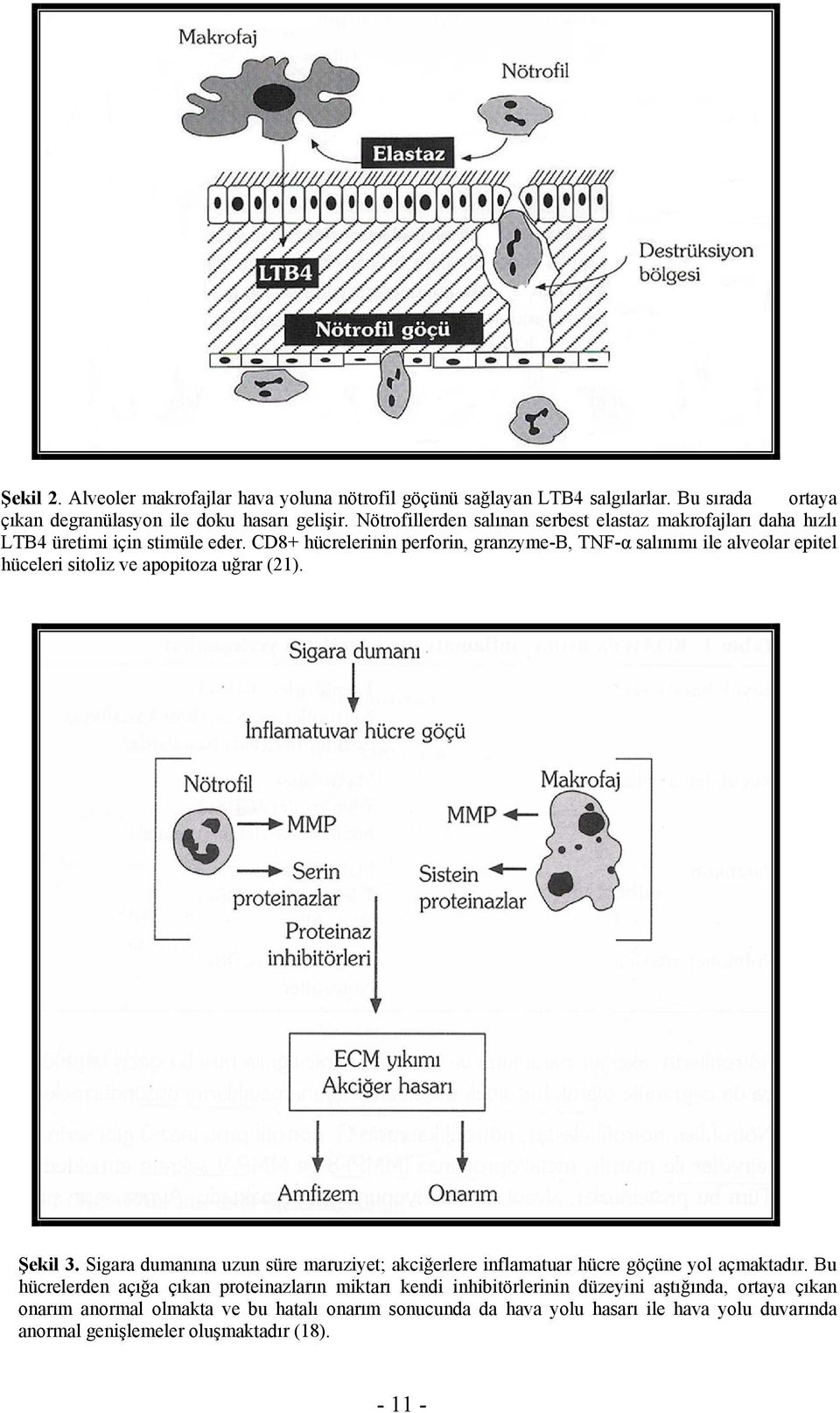 CD8+ hücrelerinin perforin, granzyme-b, TNF-α salınımı ile alveolar epitel hüceleri sitoliz ve apopitoza uğrar (21). Şekil 3.