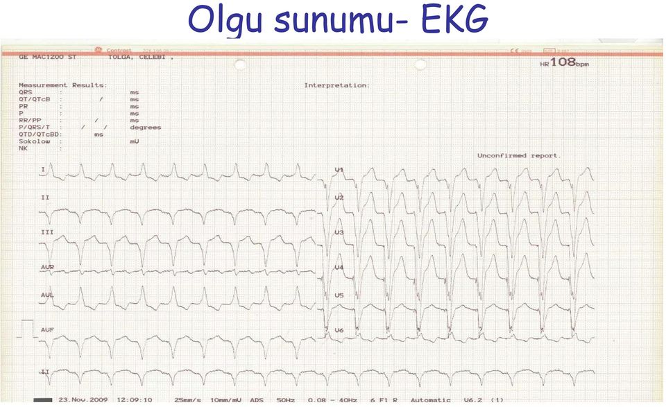 EKG