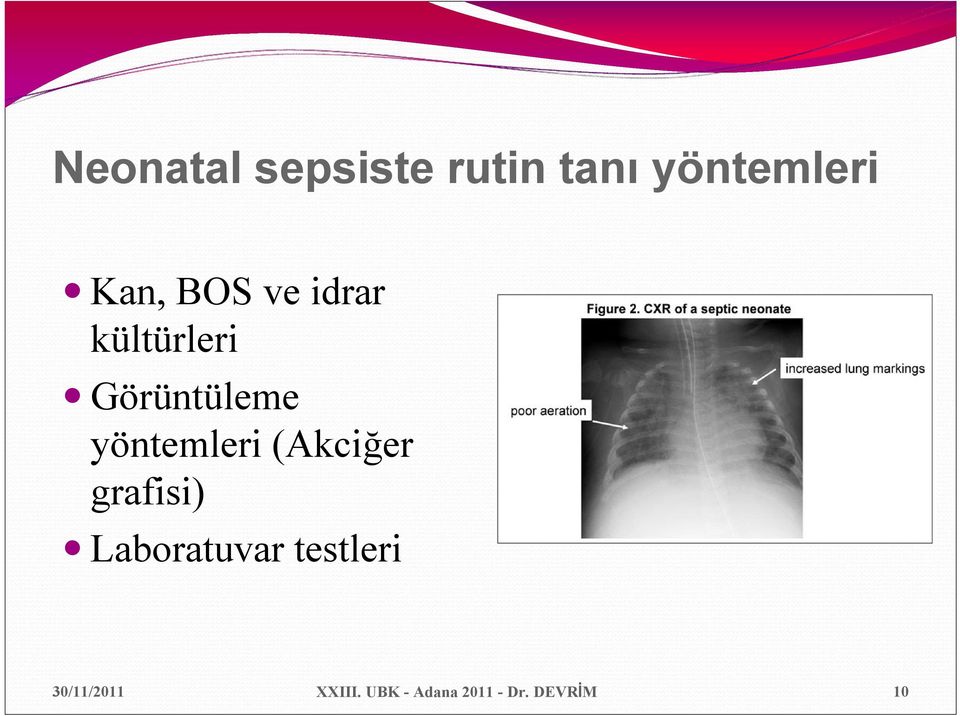 yöntemleri (Akciğer grafisi) Laboratuvar