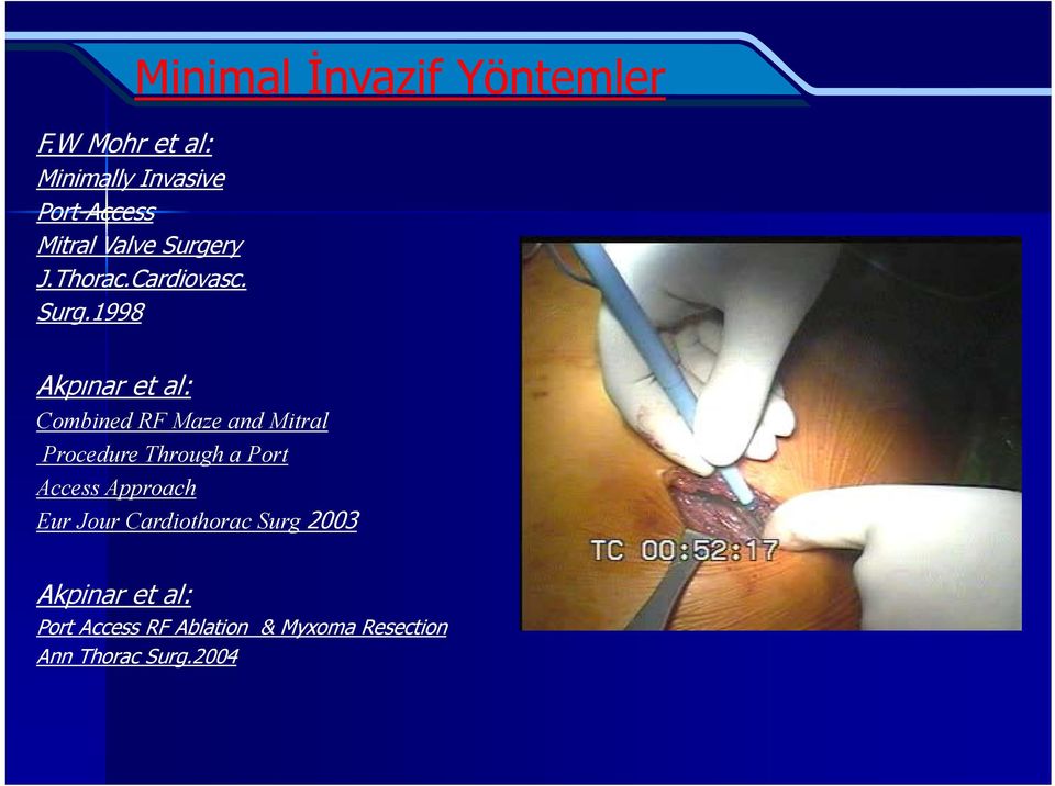 ry J.Thorac.Cardiovasc. Surg.