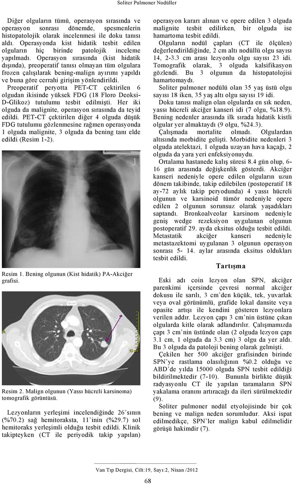 Operasyon sırasında (kist hidatik dışında), preoperatif tanısı olmayan tüm olgulara frozen çalışılarak bening-malign ayırımı yapıldı ve buna göre cerrahi girişim yönlendirildi.