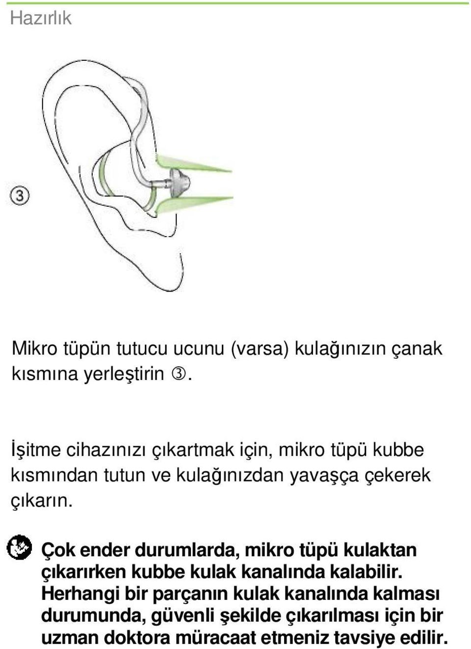 çıkarın. Çok ender durumlarda, mikro tüpü kulaktan çıkarırken kubbe kulak kanalında kalabilir.