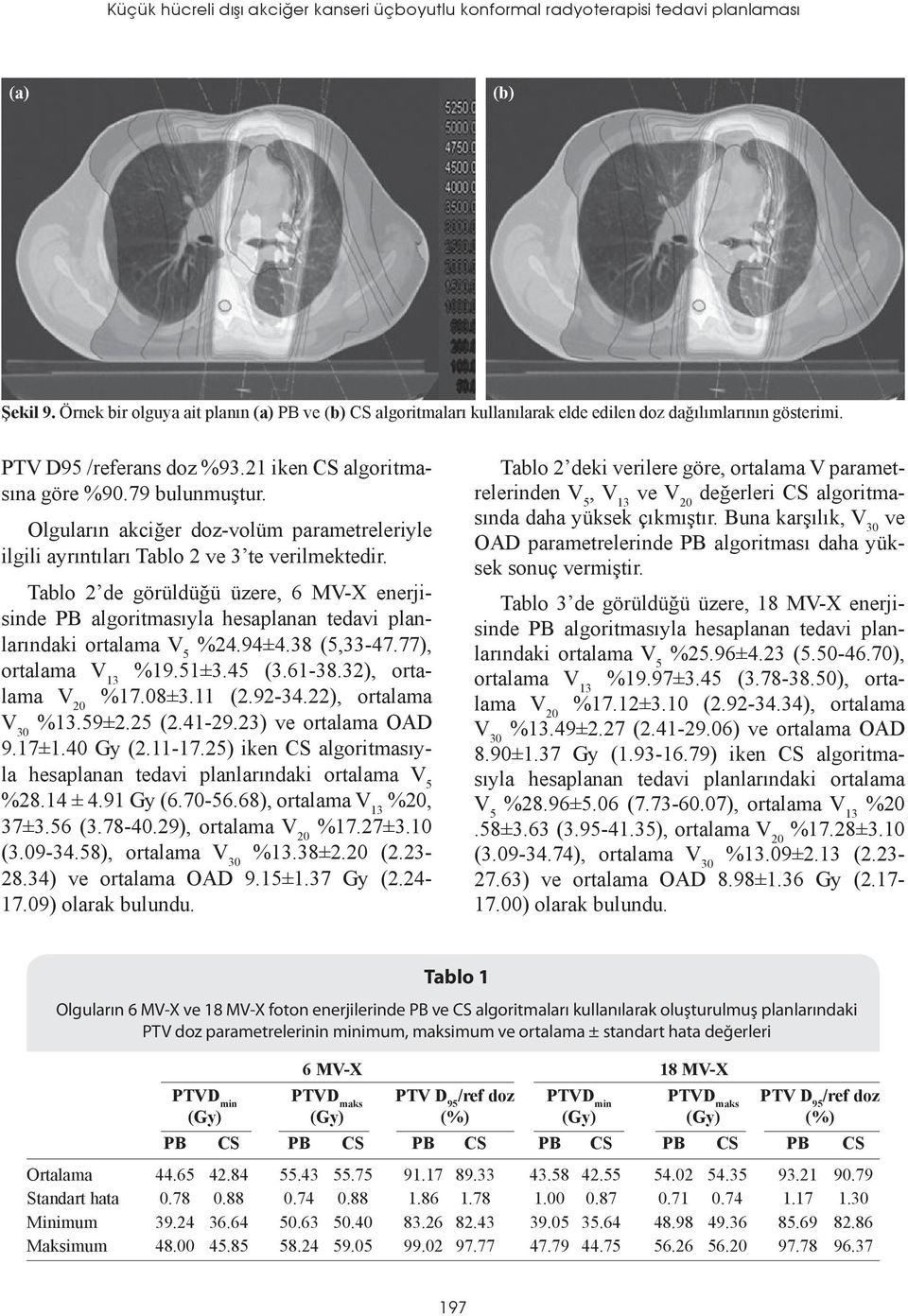 Olguların akciğer doz-volüm parametreleriyle ilgili ayrıntıları Tablo 2 ve 3 te verilmektedir.