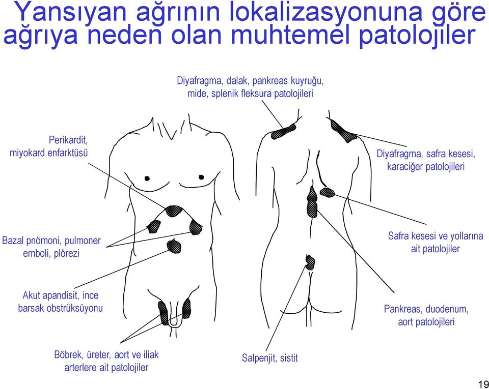 Bazal pnömoni, pulmoner emboli, plörezi Safra kesesi ve yollarına ait patolojiler Akut apandisit, ince barsak