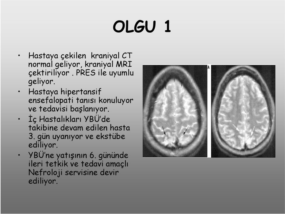 Hastaya hipertansif ensefalopati tanısı konuluyor ve tedavisi başlanıyor.