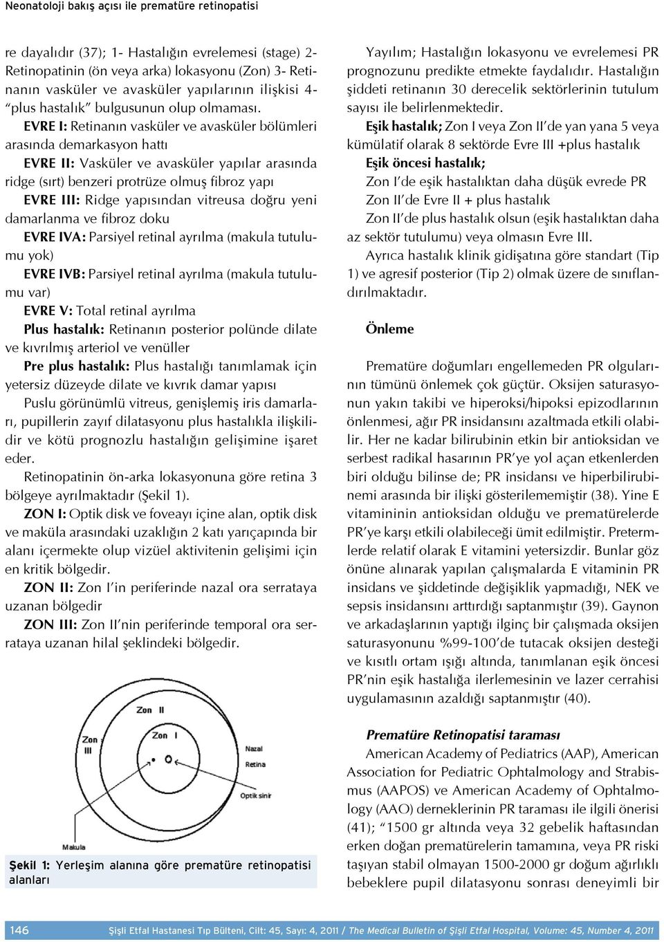 EVRE I: Retinanın vasküler ve avasküler bölümleri arasında demarkasyon hattı EVRE II: Vasküler ve avasküler yapılar arasında ridge (sırt) benzeri protrüze olmuş fibroz yapı EVRE III: Ridge yapısından