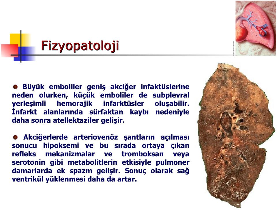 Akciğerlerde arteriovenöz şantların açılması sonucu hipoksemi ve bu sırada ortaya çıkan refleks mekanizmalar ve tromboksan