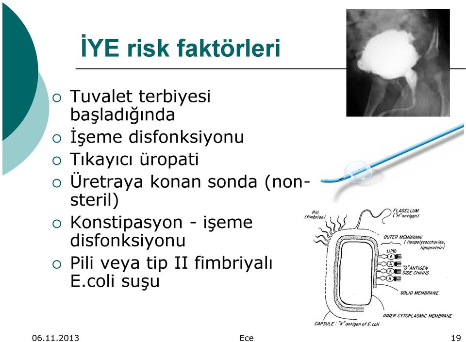 sonda (nonsteril) Konstipasyon - işeme disfonksiyonu